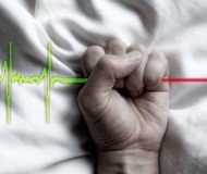 Cause of suffering decisive in euthanasia