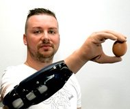 ‘Bionic reconstruction’ first