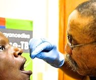 SA 'game-changer' in TB diagnosis