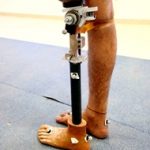 Prostheticknee