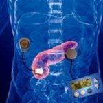 Pancreas