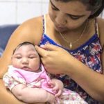 Zika