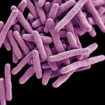 Bacteria