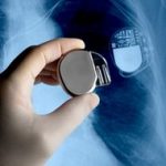Pacemaker