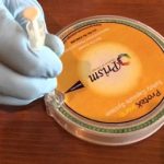 Needlestick