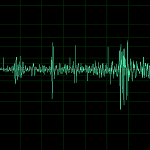 mb-110 heartr lung sounds