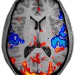mb-115 mri studies