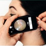 otoscope smart phone