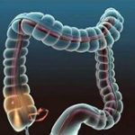 Colonoscopy