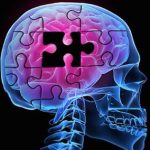 Alzheimer