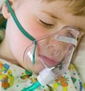 Anaesthesia