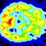 PETScan
