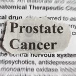 ProstateWEB