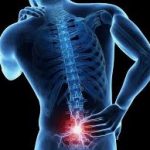 MB-143 BACK PAIN