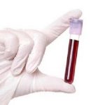 Bloodtest