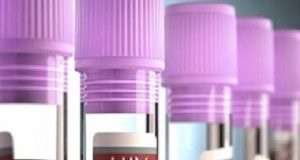 Implications stemming from evolving definitions of 'safe sex' HIVMeds