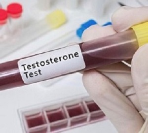 Testosterone