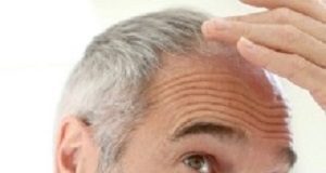 Grey hair linked with increased heart disease risk in men EdGreyhair