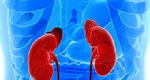 Stereotactic radiation highly effective for kidney cancer anatomy of human urogenital organs in x-ray view