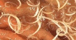 Worms and low marks are bedfellows among kids – Eastern Cape study RAWhipworms