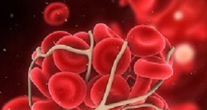 GPs prescribing anticoagulants for AF against official safety advice anticoagulants