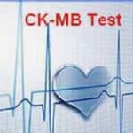 CKMBTest
