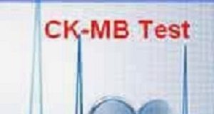 CK-MB adds no value in evaluating patients with suspected heart attack. CKMBTest