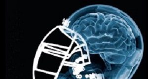 CTE almost universal among ex-NFL football players FocusFootballinjury