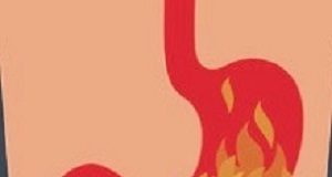 PPI use not associated with dementia, study concludes PPI