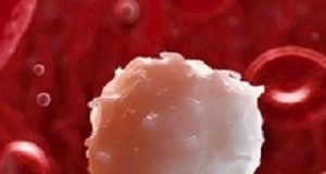 Simple, inexpensive device to quickly assess malarial progression WhiteBloodCell