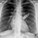 CardiacMonitor