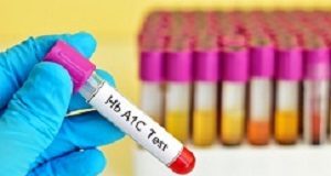 Widely used diabetes test may not be suitable for Africans Diabetes