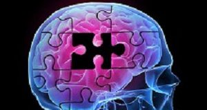 Safety and effectiveness of 4 Alzheimer's drugs ranked Alzheimers
