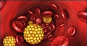 Statins have positive impact on patients with heart disease BloodCholesterol