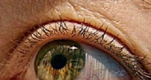 Cause of dyslexia is in the eyes' light-receptor cells — Royal Society study EyeLightReceptor