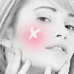 MB-184 abscess.jpg