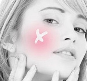 MB-184 abscess.jpg