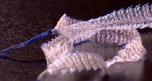 Mandatory clinical trials needed for implanted medical devices — Oxford study MeshMore