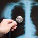 Pneumonia