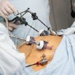 Portrait of gastric bypass surgery in hospital