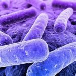 Listeriosis