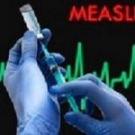 Measles