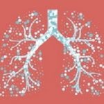 Asthma