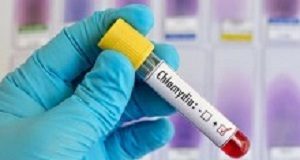 Young rural SA women more vulnerable to STIs than young men Chlamydia