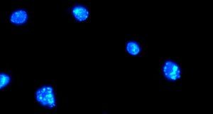 Promising family of silver-based anti-cancer drugs discovered UJ3