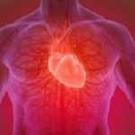 Cardiovascular