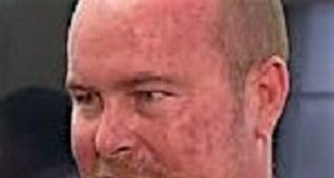 Australian Outback nurse self-treats heart attack Franks