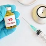 Tuberculosis
