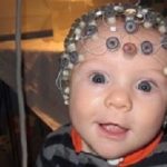 EEGs