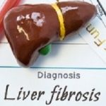 Liverfibrosis